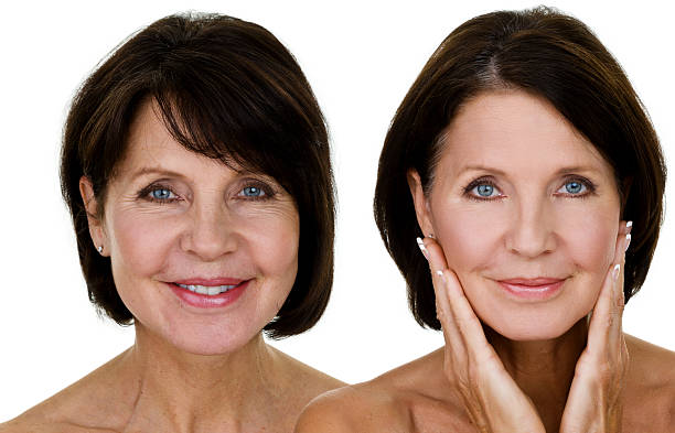 Face rejuvenation before and after results