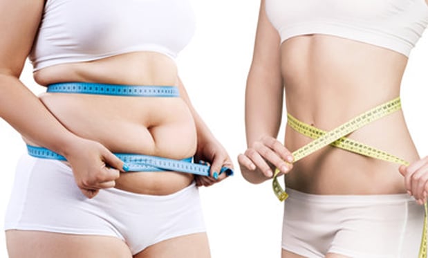 Tummy Tuck before after results